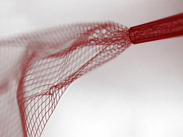 Neural Lace